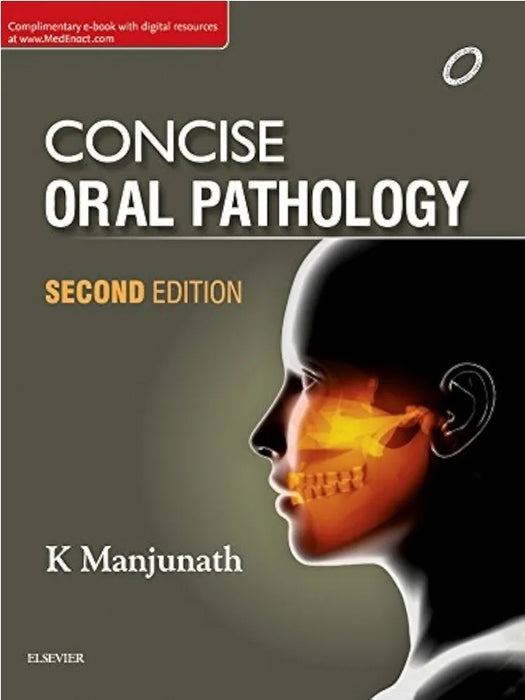 Concise Oral Pathology, 2e by k Manjunath