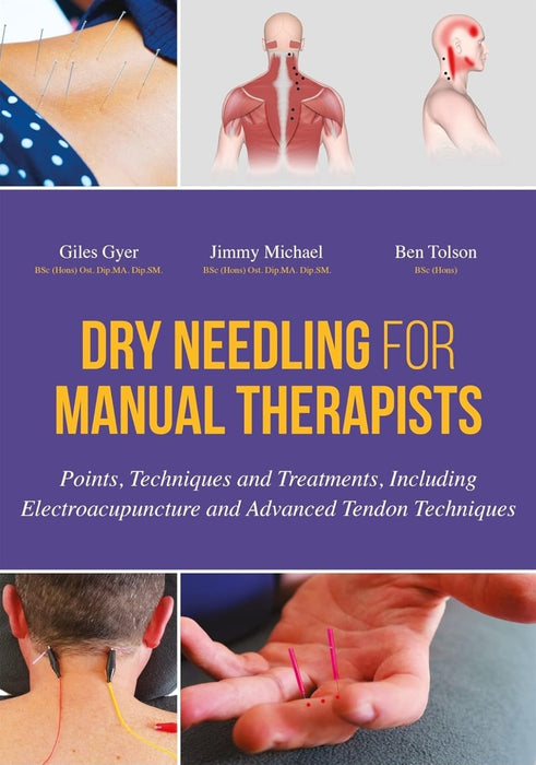 DRY NEEDLING FOR MANUAL THERAPISTS