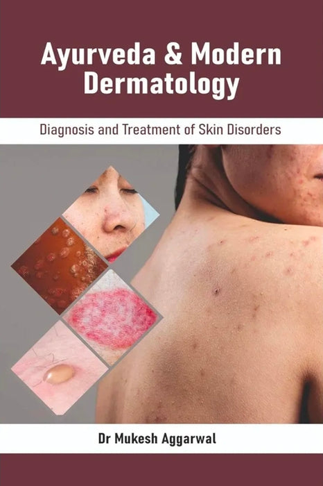 Dr. Mukesh Aggarwal Ayurveda & Modern Dermatology : Diagnosis and Treatment of Skin Disorders